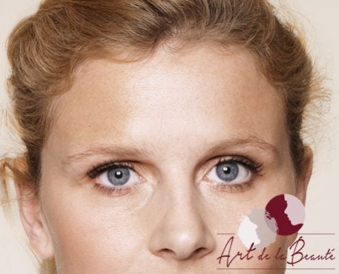 Foto van na de behandeling met botox van voorhoofdrimpels vrouw close-up