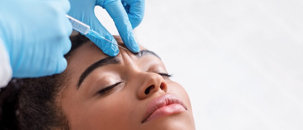 botox voorhoofd rimpels naar beneden gezakt
